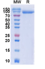 SDS-PAGE for CD6 recombinant protein