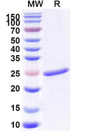 SDS-PAGE for CLCF1, N-His, recombinant protein