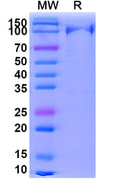 SDS-PAGE for EndoS