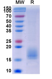 SDS-PAGE for Human ACVR1B recombinant protein