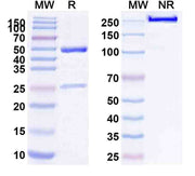 Human CD240D/RHD (SAA0076) Monoclonal Antibody