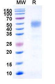 SDS-PAGE for Human CD332-FGFR2 recombinant protein