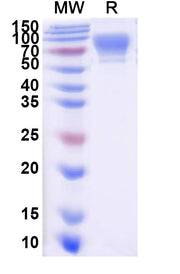 SDS-PAGE for Human CD6 recombinant protein