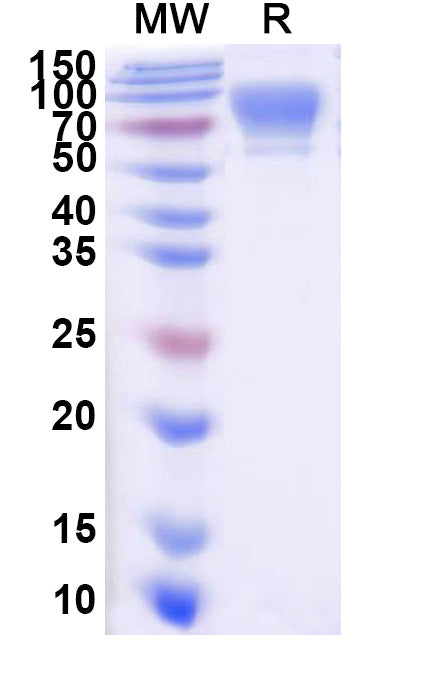 SDS-PAGE for Human CD6 recombinant protein