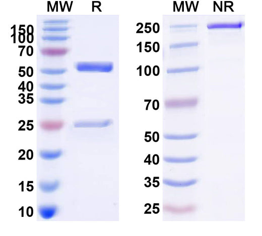 SDS-PAGE for Human CD89/FCAR Monoclonal Antibody