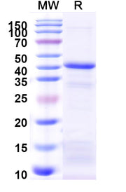 SDS-PAGE for Human DKK3 recombinant protein