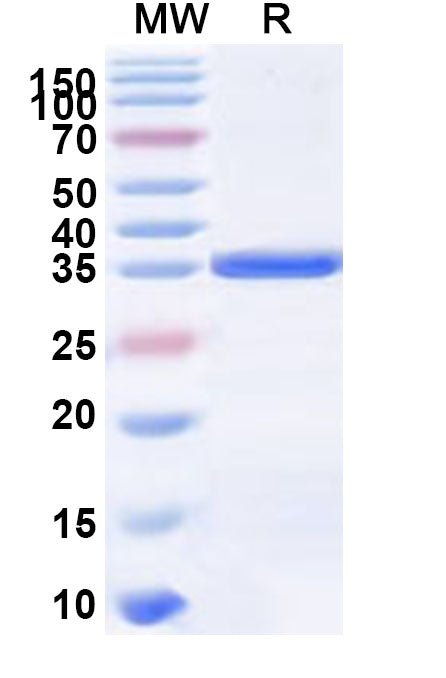 SDS-PAGE for Human EPGN Recombinant Protein, N-GST & C-His