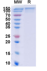 SDS-PAGE for Human IL13RA2 recombinant protein