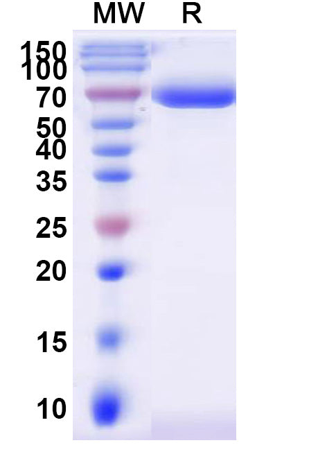 SDS-PAGE for Human ST6GAL1 recombinant protein