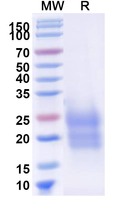 SDS-PAGE for Human TDGF1 recombinant protein