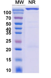SDS-PAGE for Human TRAC Monoclonal Antibody