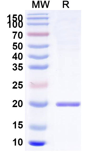 SDS-PAGE for IL11, N-His, recombinant protein
