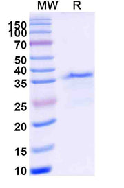 ITGAL recombinant protein