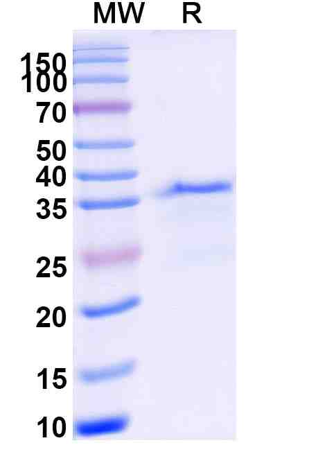 ITGAL recombinant protein