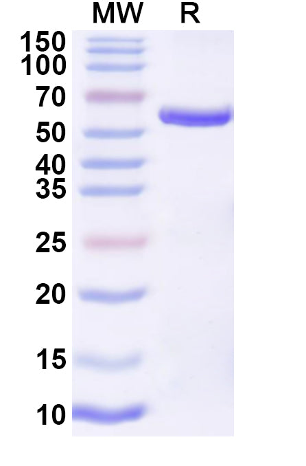SDS-PAGE for JUNV Nucleoprotein, N-His