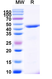 SDS-PAGE for Keratin, type I cytoskeletal 19(KRT19)