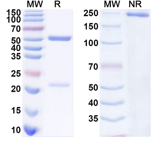 SDS-PAGE for Mouse Anti-DNA Recombinant Autoantibody (PME77)