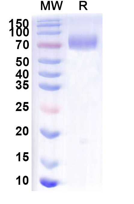 SDS-PAGE for Mouse CD6 Recombinant Protein, C-Fc