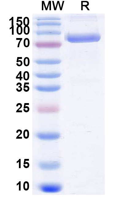SDS-PAGE for Mouse CD71/TFRC Recombinant Protein, C-His
