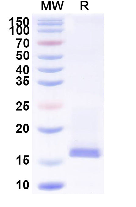 SDS-PAGE for Mouse CST3 Recombinant Protein, C-His