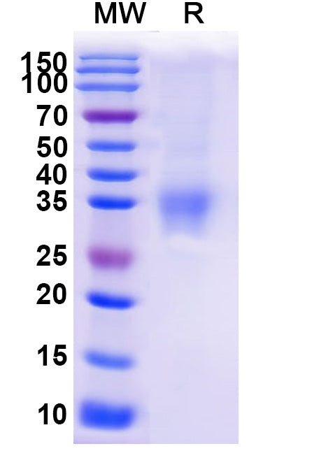 SDS-PAGE for Mouse EFNA3 Recombinant Protein, C-His
