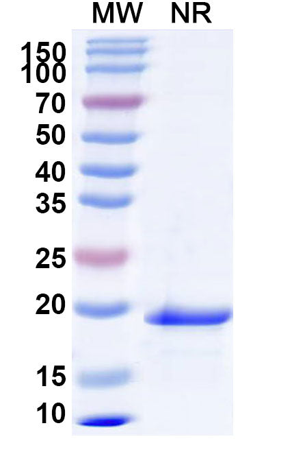 SDS-PAGE for Mouse IL24 Recombinant Protein, N-His
