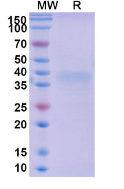 SDS-PAGE for Mouse LAYN recombinant protein