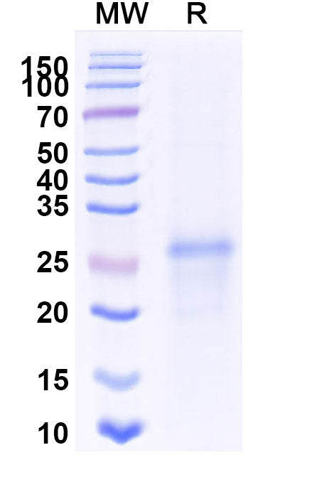SDS-PAGE for Mouse SDC4 recombinant protein