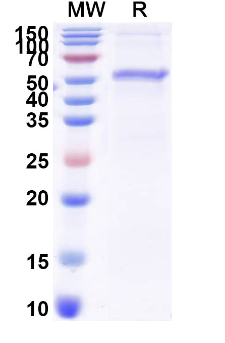 SDS-PAGE for Mouse SORT1 Recombinant Protein, N-His