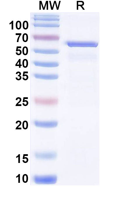 SDS-PAGE for NR3C1, N-His, recombinant protein