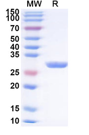 SDS-PAGE for PINK1, N-His, recombinant protein