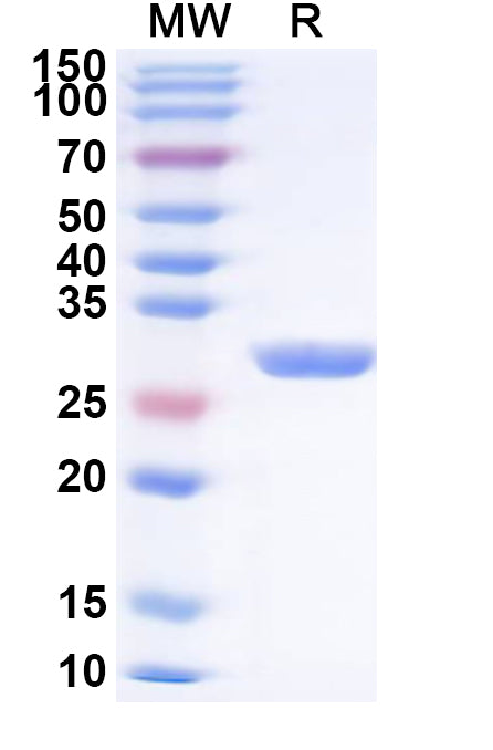SDS-PAGE for PINK1, N-His, recombinant protein