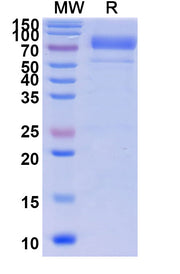 SDS-PAGE for Prothrombin(F2)