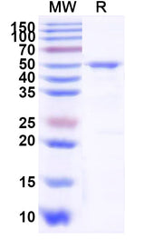 SDS-PAGE for PSMC3, N-His, recombinant protein