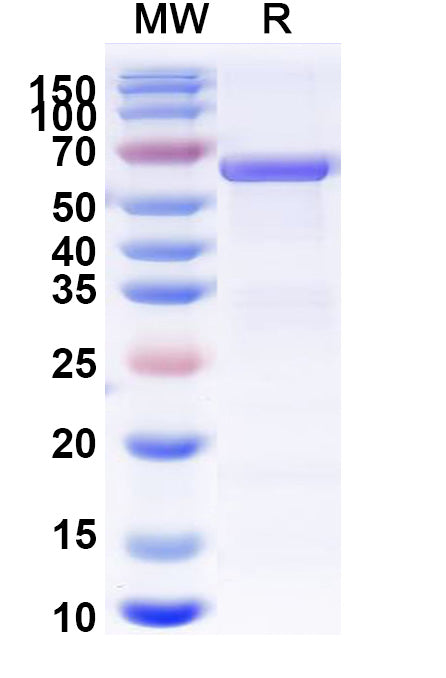 SDS-PAGE for Pyruvate kinase PKM(PKM)