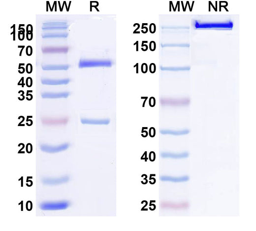SDS-PAGE for Recombinant Anti-HLA-A2-peptide (ITDQVPFSV) Complex (1A7)