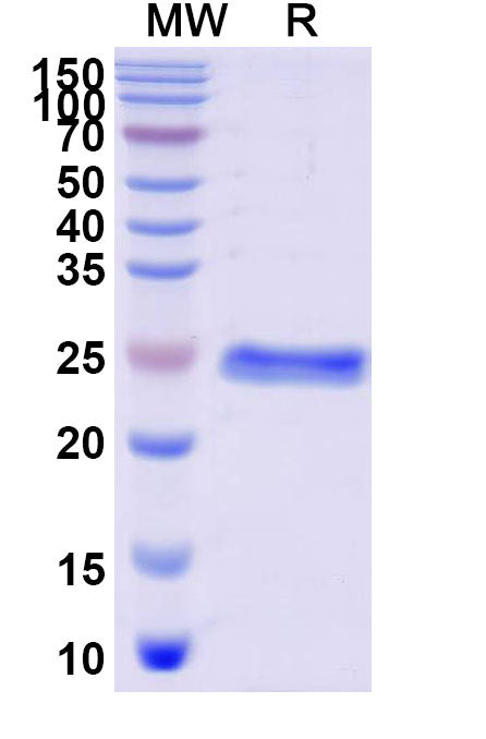 SDS-PAGE for Recombinant Human AMBP, N-His
