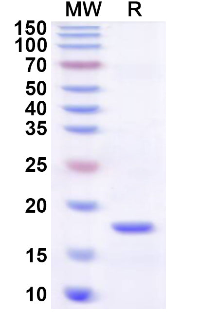 SDS-PAGE for Recombinant Human ATF7IP Protein, N-His
