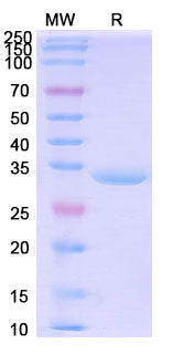 SDS-PAGE for Recombinant Human CBR1, N-His