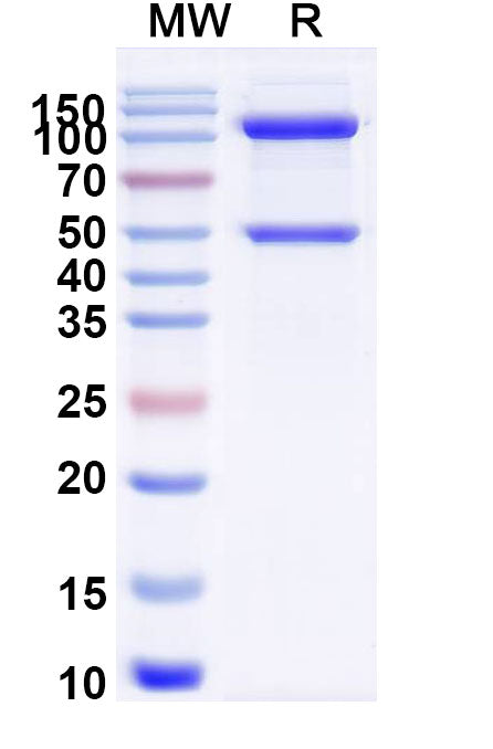 SDS-PAGE for Recombinant Human CRBN & DDB1 Protein, N-Strep & C-His