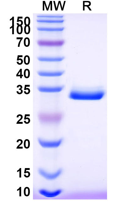 SDS-PAGE for Recombinant Human CTSB, N-His