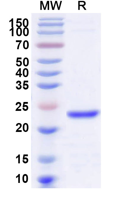 SDS-PAGE for Recombinant Human DUSP11, N-His