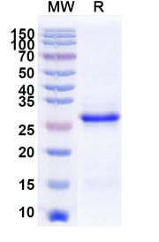 SDS-PAGE for Recombinant Human EEF1A1, N-His