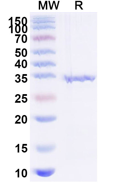 SDS-PAGE for Recombinant Human FN1 Protein, N-His