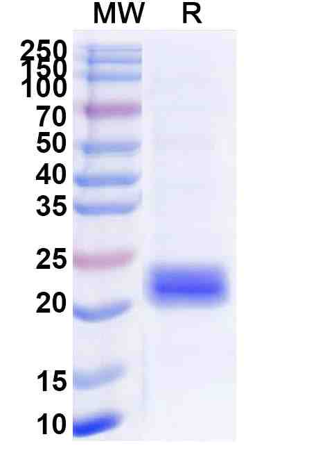 Recombinant Human GLUT4/SLC2A4, N-SUMO