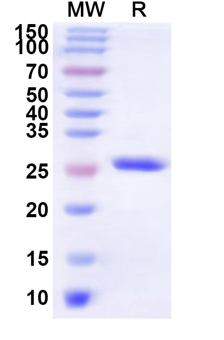 SDS-PAGE for Recombinant Human GPER1 Protein, N-His-KSI