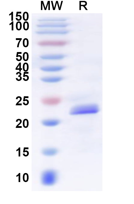 SDS-PAGE for Recombinant Human GPR39 Protein, N-His