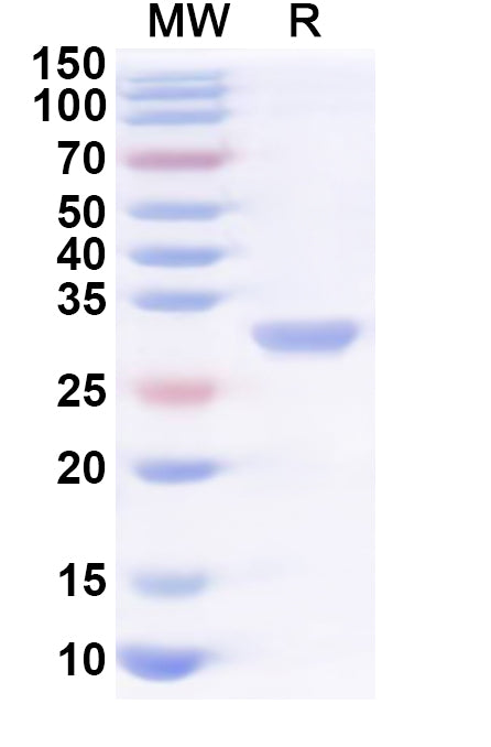 SDS-PAGE for Recombinant Human KDSR Protein, N-His