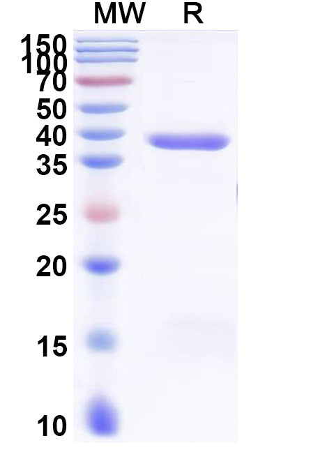 SDS-PAGE for Recombinant Human KRT33A, N-His