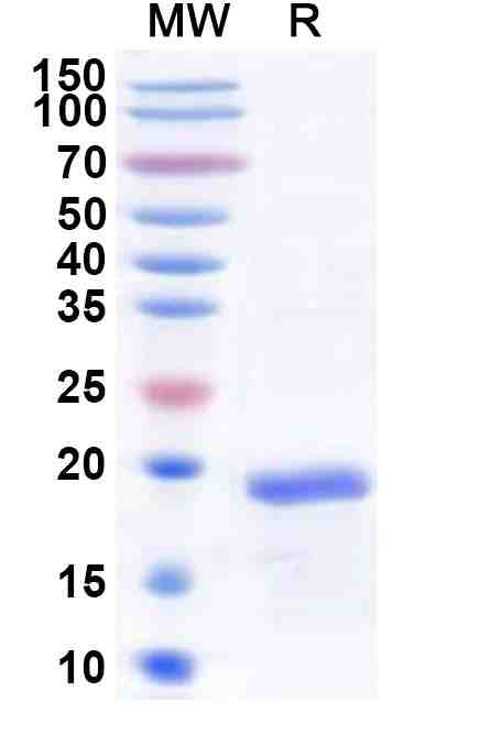Recombinant Human LMO1 Protein, N-His